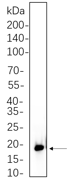 4E-BP1 (Phospho 4E-BP1 (Phospho Thr37/46))