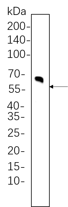 Tyrosine Hydroxylase