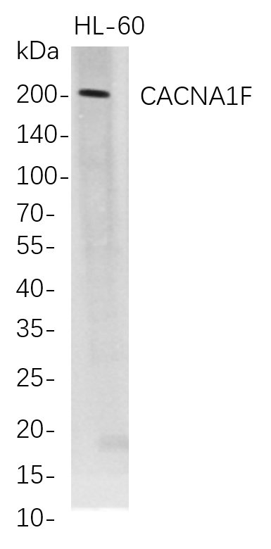 CACNA1F
