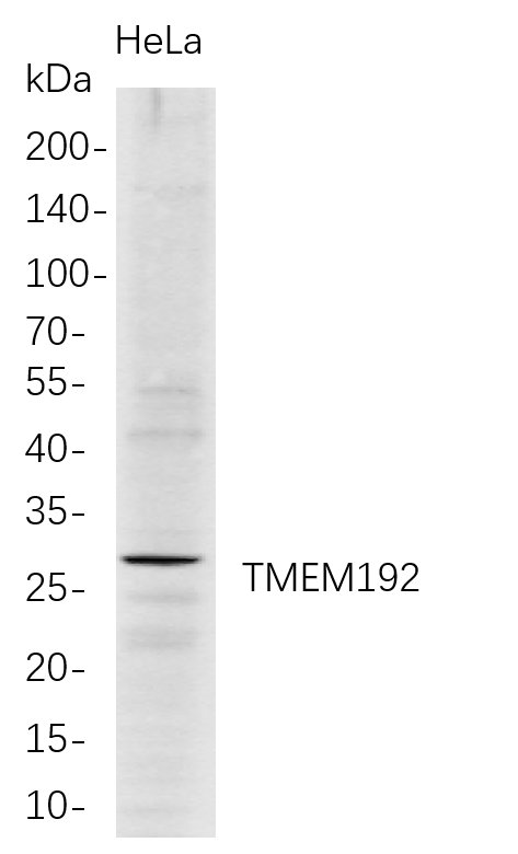 TMEM192