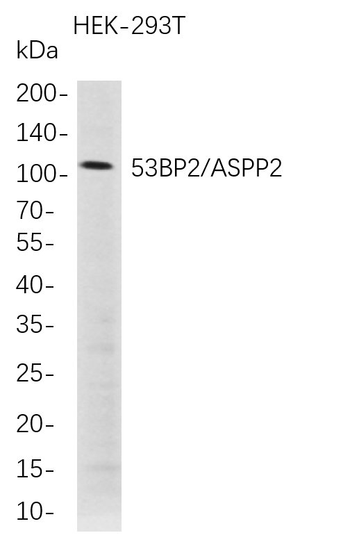 53BP2/ASPP2