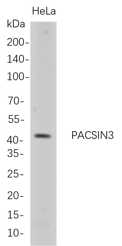 PACSIN3