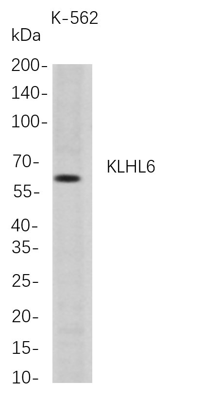 KLHL6
