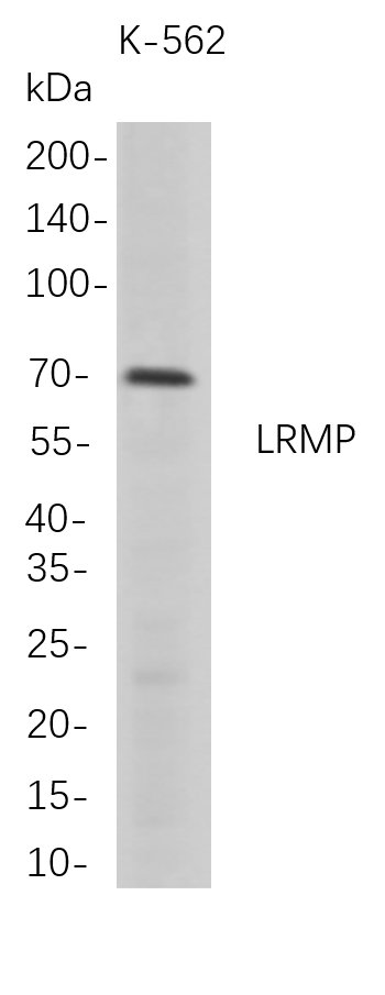 LRMP