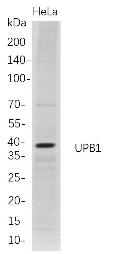 UPB1