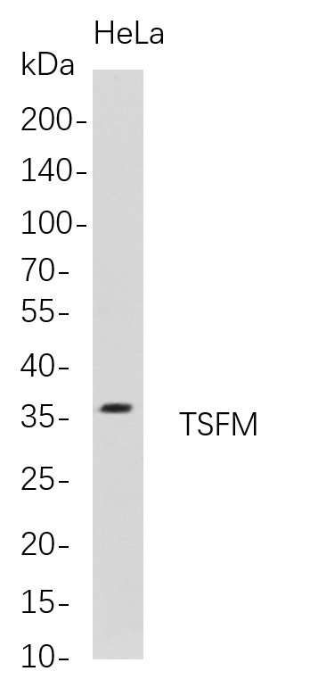 TSFM