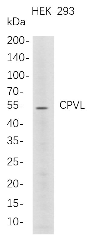 CPVL