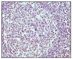 CD19