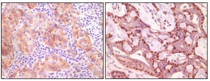 SNCG (breast cancer-specific protein 1)