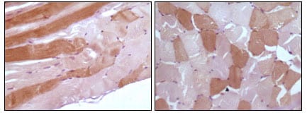 Myoglobin