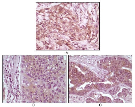 4E-BP1