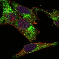 INHA (Inhibin alpha)