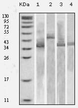 Thioredoxin (TRX)