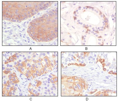 Cytokeratin 5
