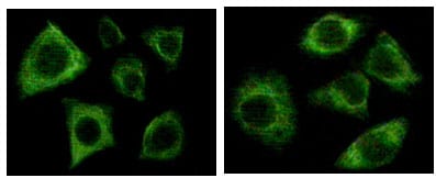 Cytokeratin (Pan)
