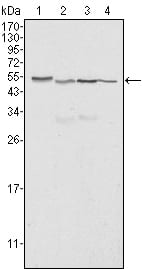 Calreticulin