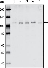 EhpB1