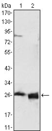 APOA1