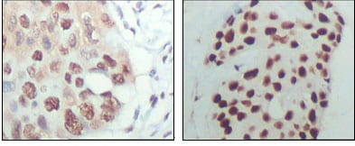 HDAC3