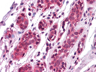 EphA7