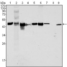 Cytokeratin 18
