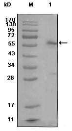 ESR1