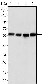 Vimentin