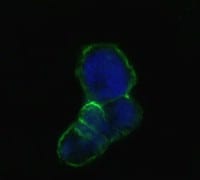 LCN1