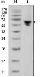 human IgG (Fc Specific)
