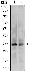 CDK4