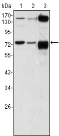 ATP2C1