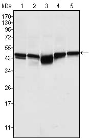 GSK3B