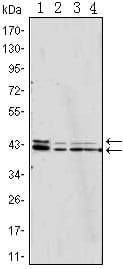 p44/42 MAPK (Erk1/2)