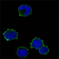 CD247