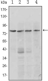 PRDM1