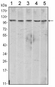 CDH2