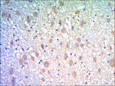 KLHL21