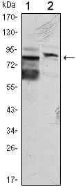 KLHL11