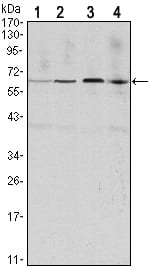 CCNB1