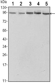 STAT3