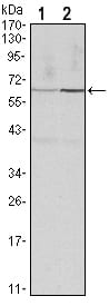 CCNB1