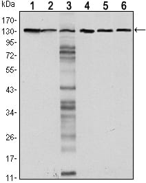 CDH1
