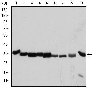CDK1