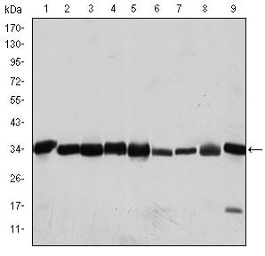 CDK1