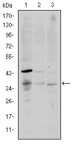 CD1A