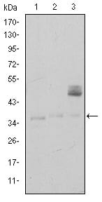 CD1A
