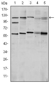 HIF1A
