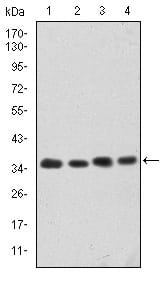 CDK5