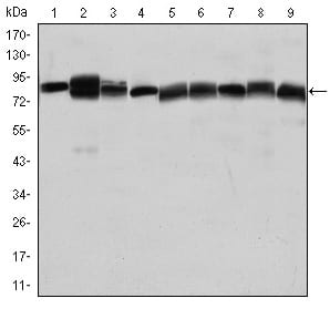 HSP90AB1