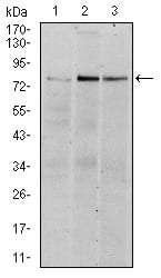 RSK2